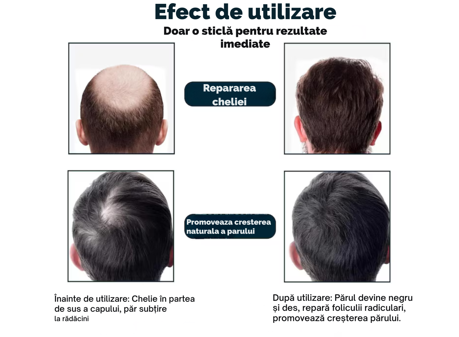 Nanofibre  din keratina pura pentru par rar, FITUNIVERSAL, pudra cu cu fibre pentru par mai des instant, rezistenta la apa, nanofibre de Keratina, Maro mediu, Medium Brown