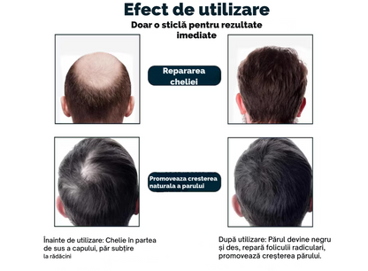 Nanofibre  din keratina pura pentru par rar, FITUNIVERSAL, pudra cu cu fibre pentru par mai des instant, rezistenta la apa, nanofibre de Keratina, Maro mediu, Medium Brown